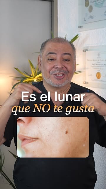 Portada de UCPER en Instagram: Tus dudas, explicadas por el doctor