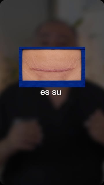 Portada de UCPER en Instagram: Cada caso tiene su historia